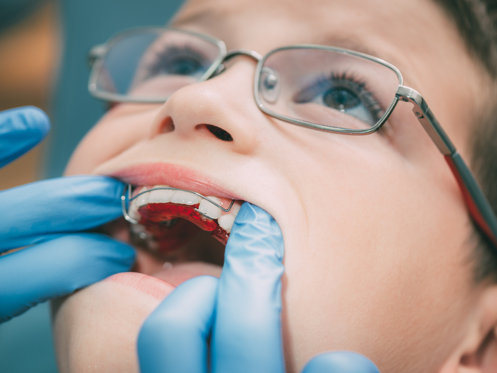 Braces For Children