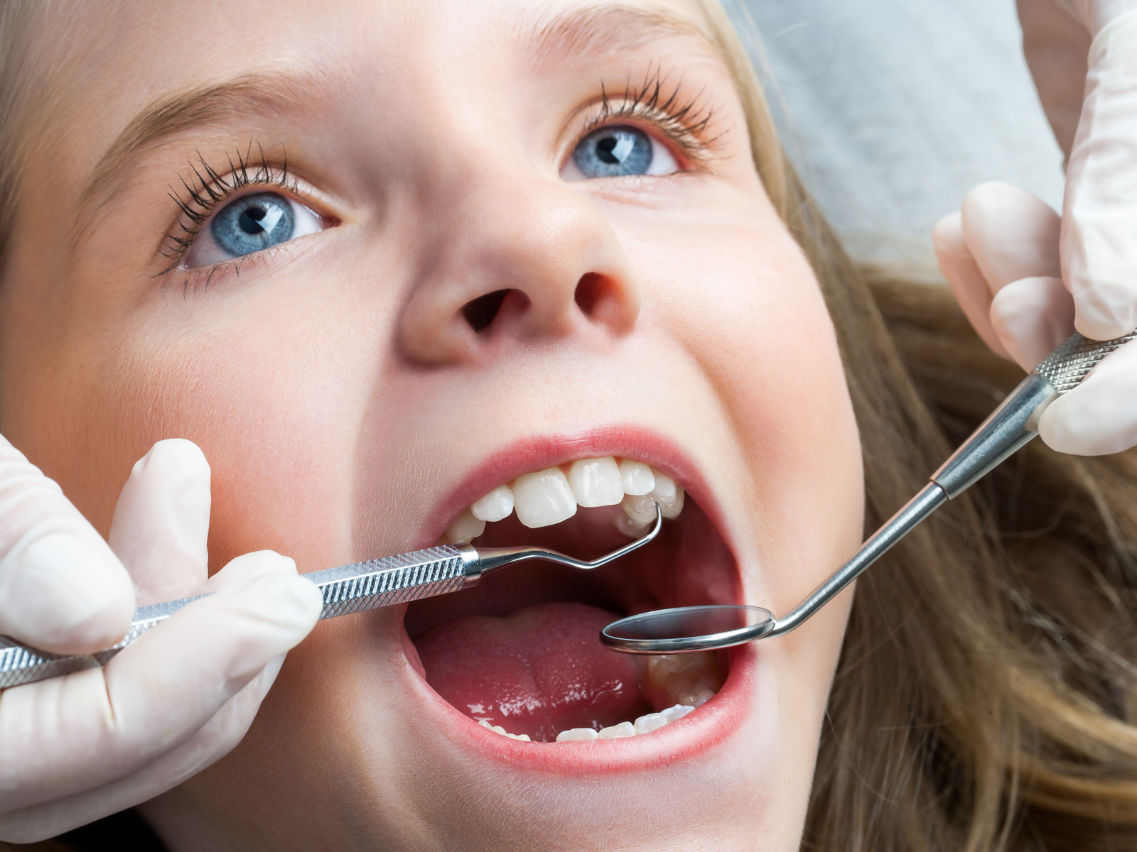 Little girl receiving a dental check-up at clinic