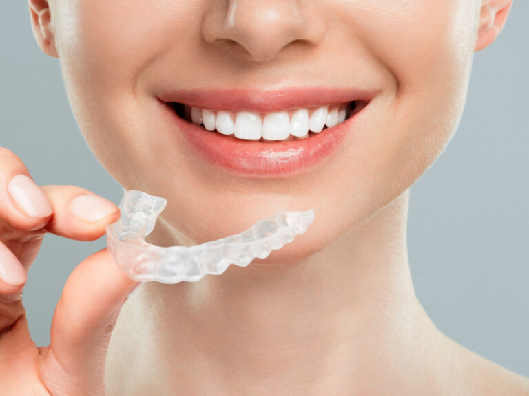 Invisalign Clear Aligners – Everything You Need To Know