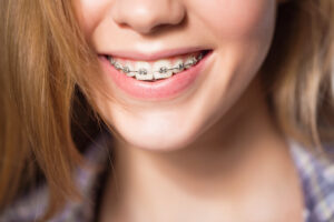 Smiling young Asian woman with retainer braces