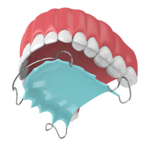 3D render of jaw with orthodontic removable retainer