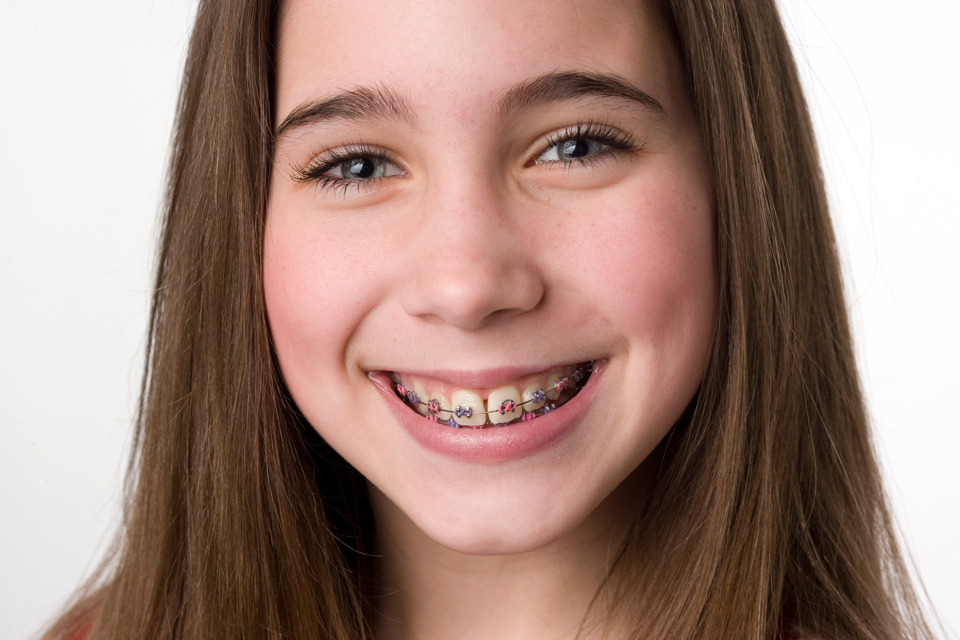 Young female smiling with braces in orthodontic office