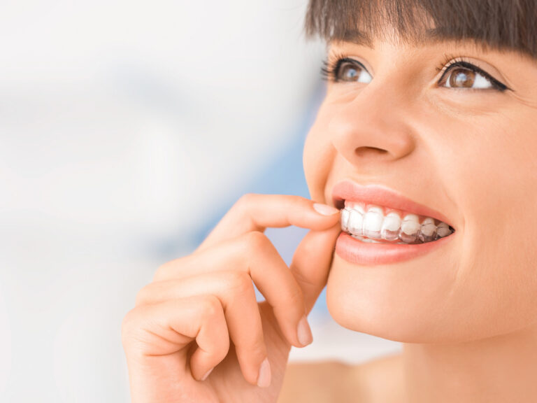 How Much Does Invisalign Cost