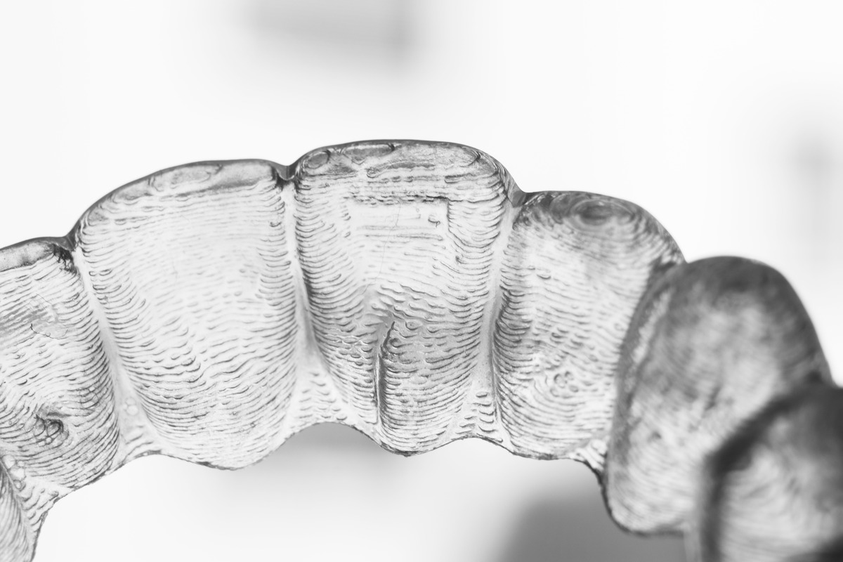 Invisible aligners for orthodontic treatment in Saratoga