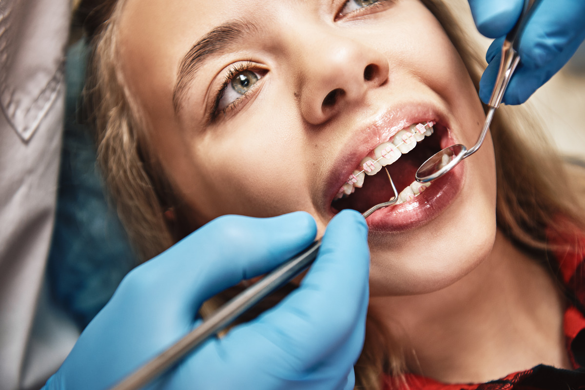 Orthodontic Treatment Options