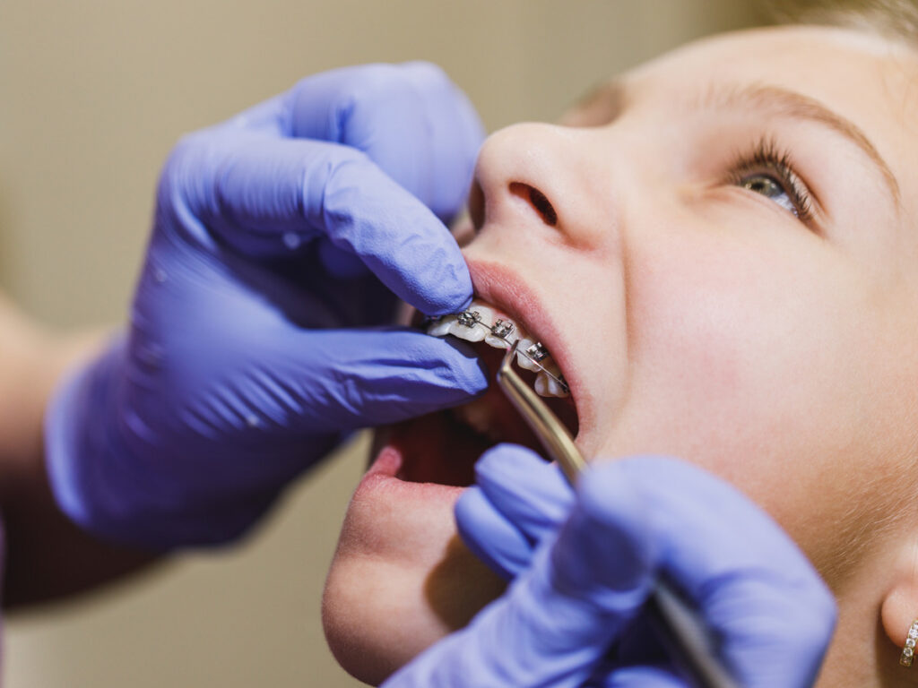 What are the different types of orthodontic services?
